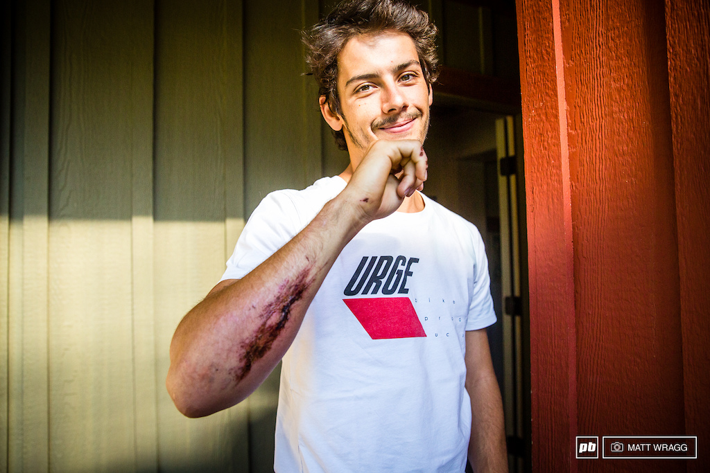 Alex Cure managed to put 20 stitches in his arm while riding before this race. He's tough, so we doubt it will slow him down too much.