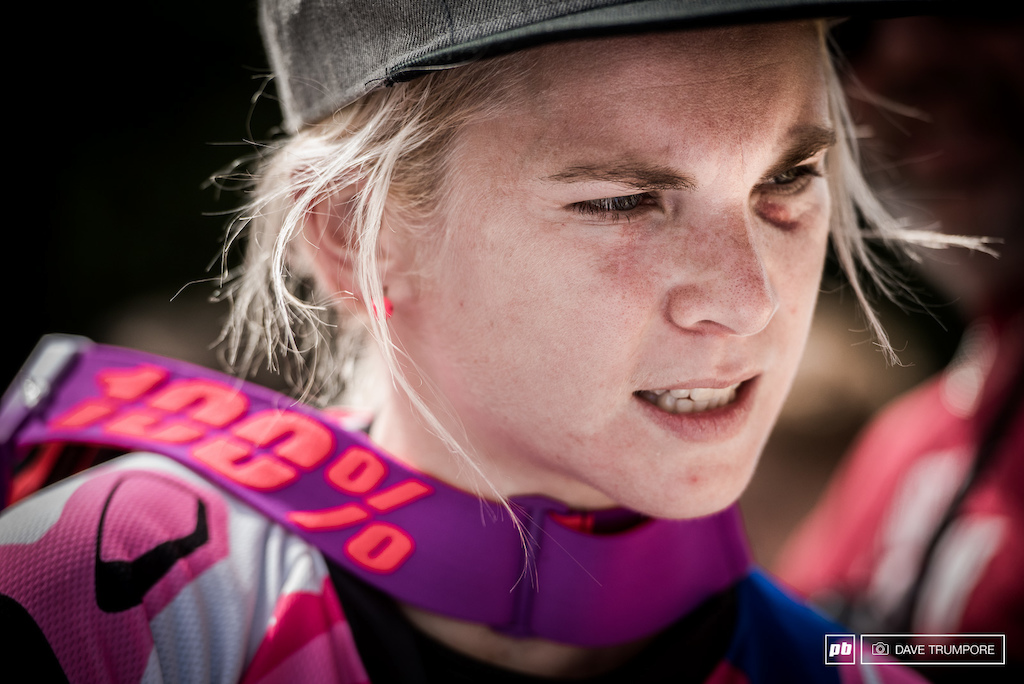 Black eye and all, Tracey Hannah dug deep after taking some pretty had hits this weekend.  Finish second to Rachel Atherton and inching closer to second in the overall as well.