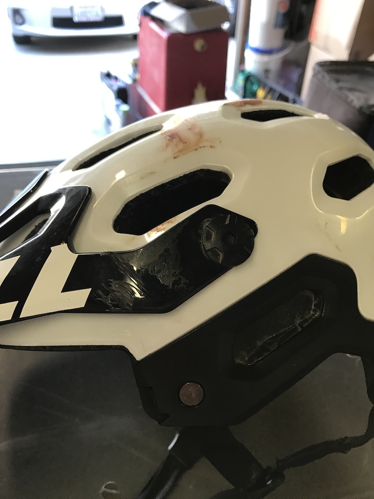 Cracked this helmet, not sure if MIPS helped but I'm glad I had it any ways.