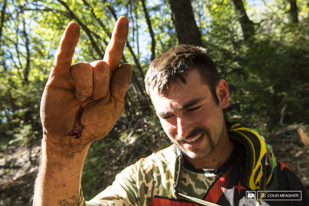 Hurts so good--Bobbie carcassed hard on the brief "Vigilante Trail" practice near the day's end and put a fun tattoo into his palm. He'd race stages 1 thru 5, but ultimately he'd DNF. Next year, Bobbie, next year.