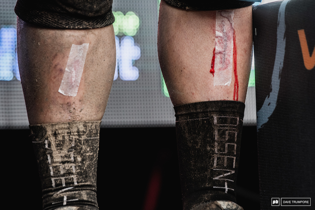 Richie Rude bleeding for his first win since Whistler in 2016.