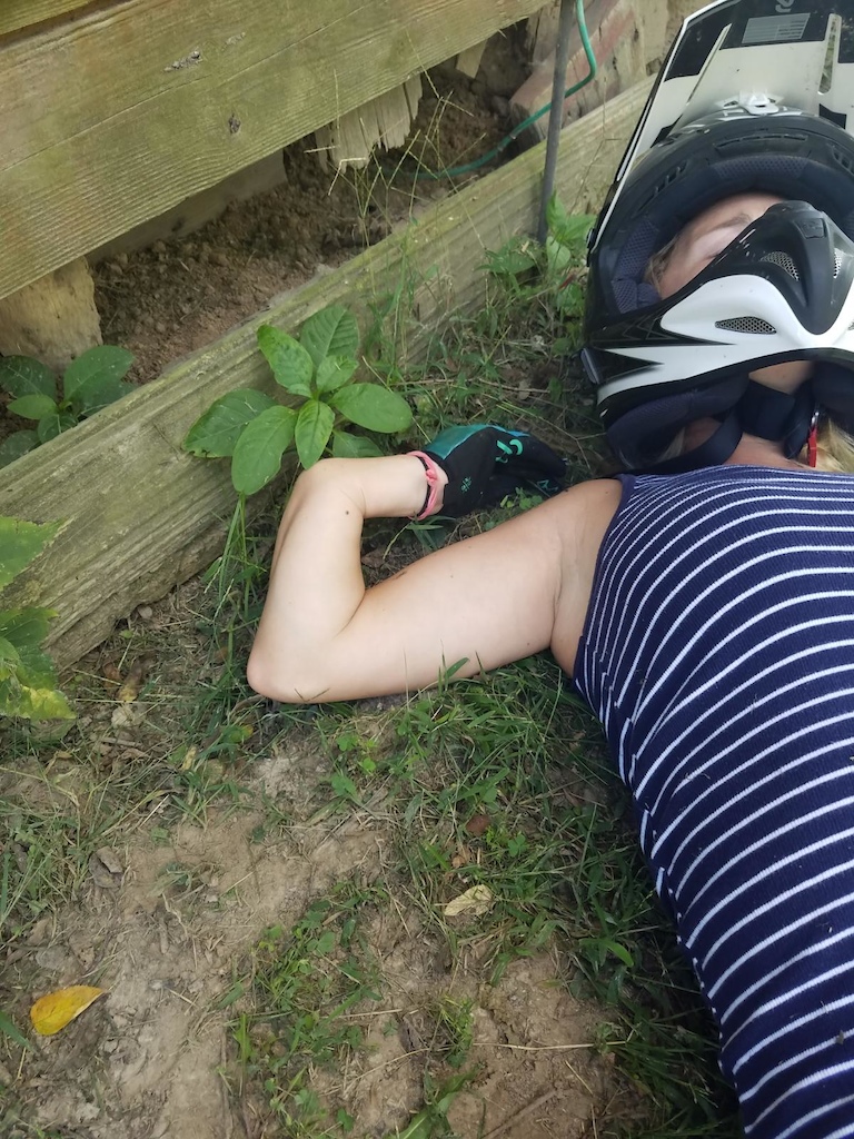My poor wife all busted up after she crashed my moto