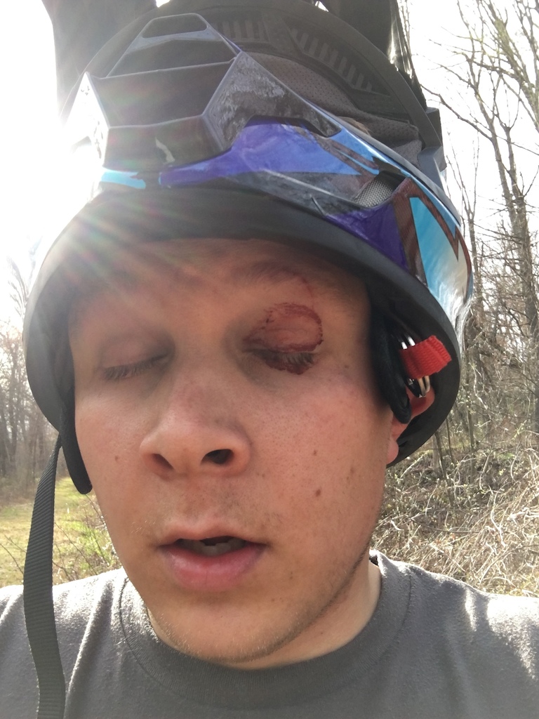Friendly PSA, always wear your eye protection when out on the trails!