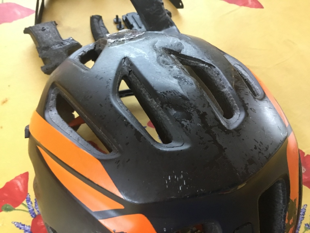 My Helmet after slamming into a tree, and losing my brakes in 2019.  It saved my life, but I had a concussion, and had to be in my bedroom for months!