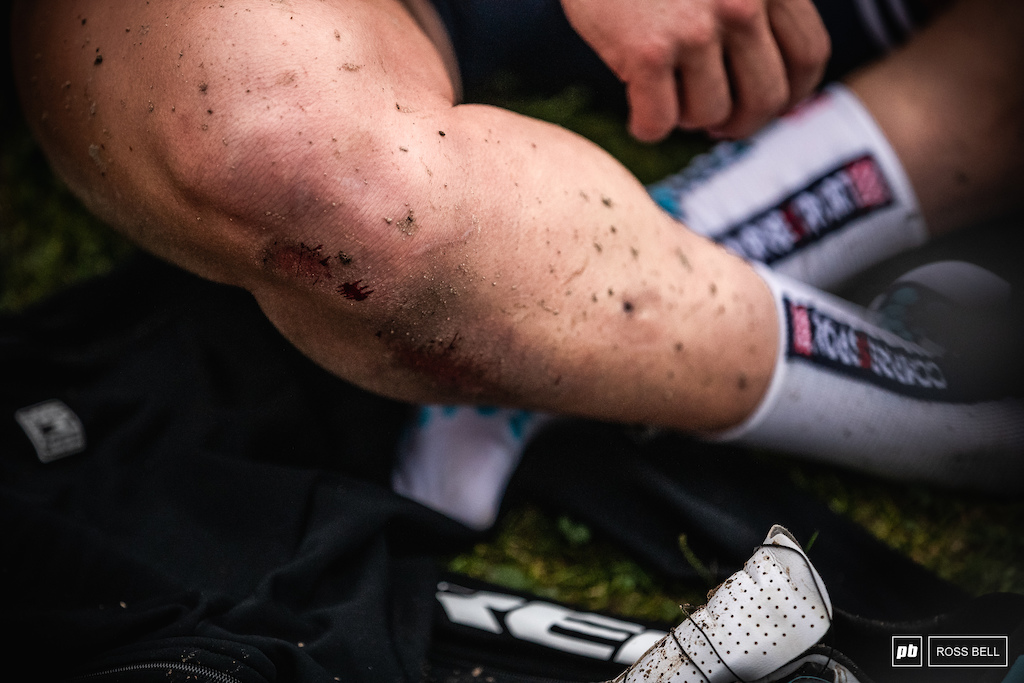 Tarmac is always going to win in a fight against skin. Evie Richards somehow managed to recover from a second to last lap crash to win.