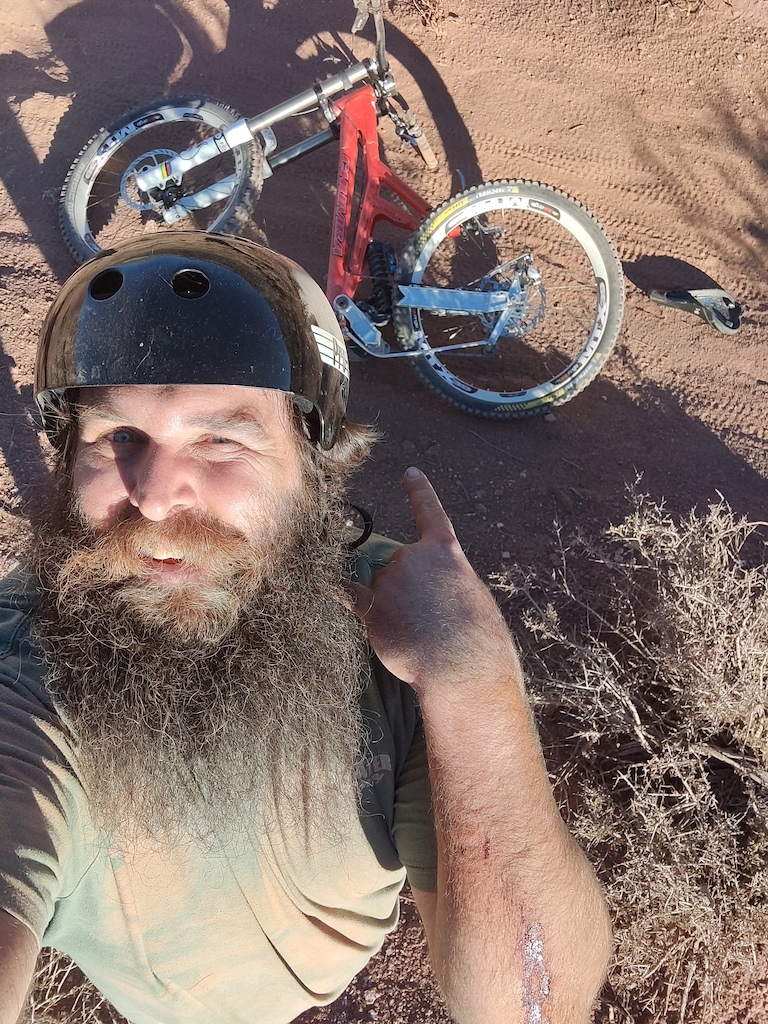 Delayed onset ankle injury from going 45ft out on a 12ft jump lasted about 4 months, but otherwise... Pretty lucky on the flesh side of things