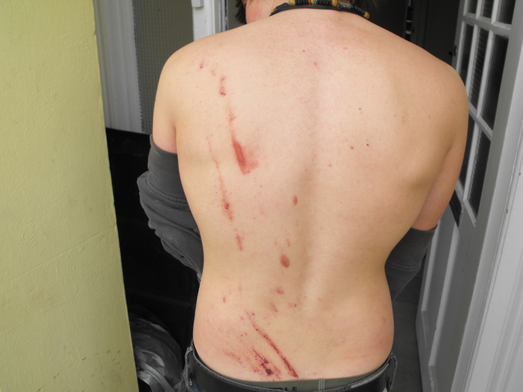 my back after being used to snap a 5 inch thick wooden post out the ground :(

stupid moelfre