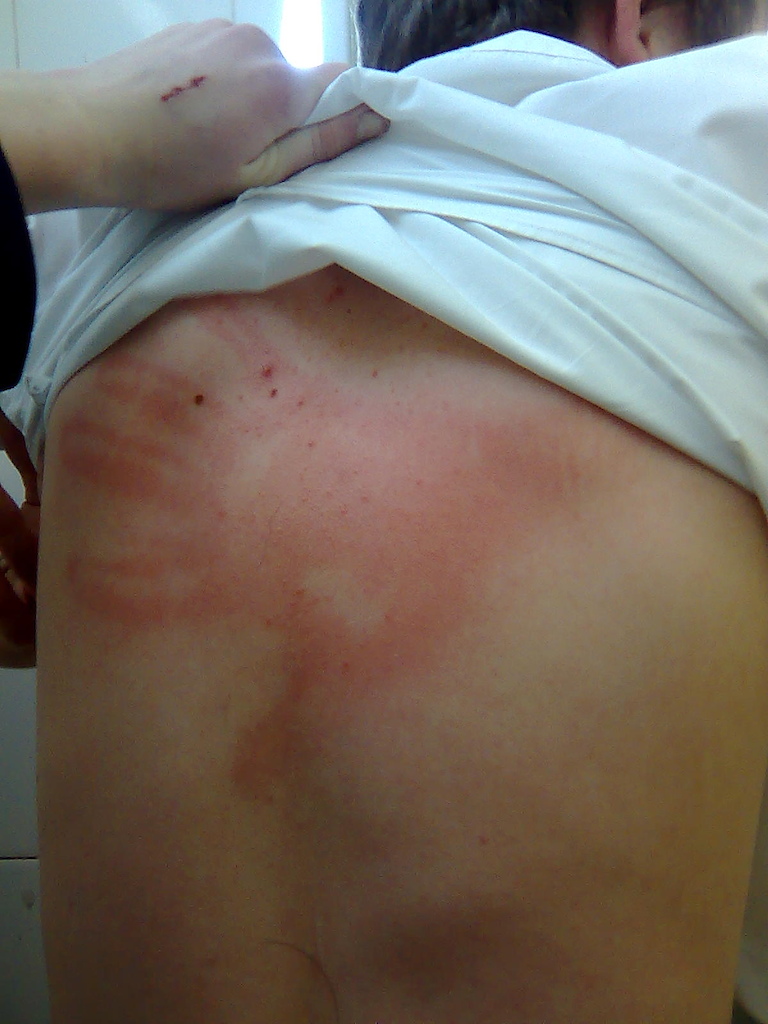 when i goT slapped :P ahahaaa
