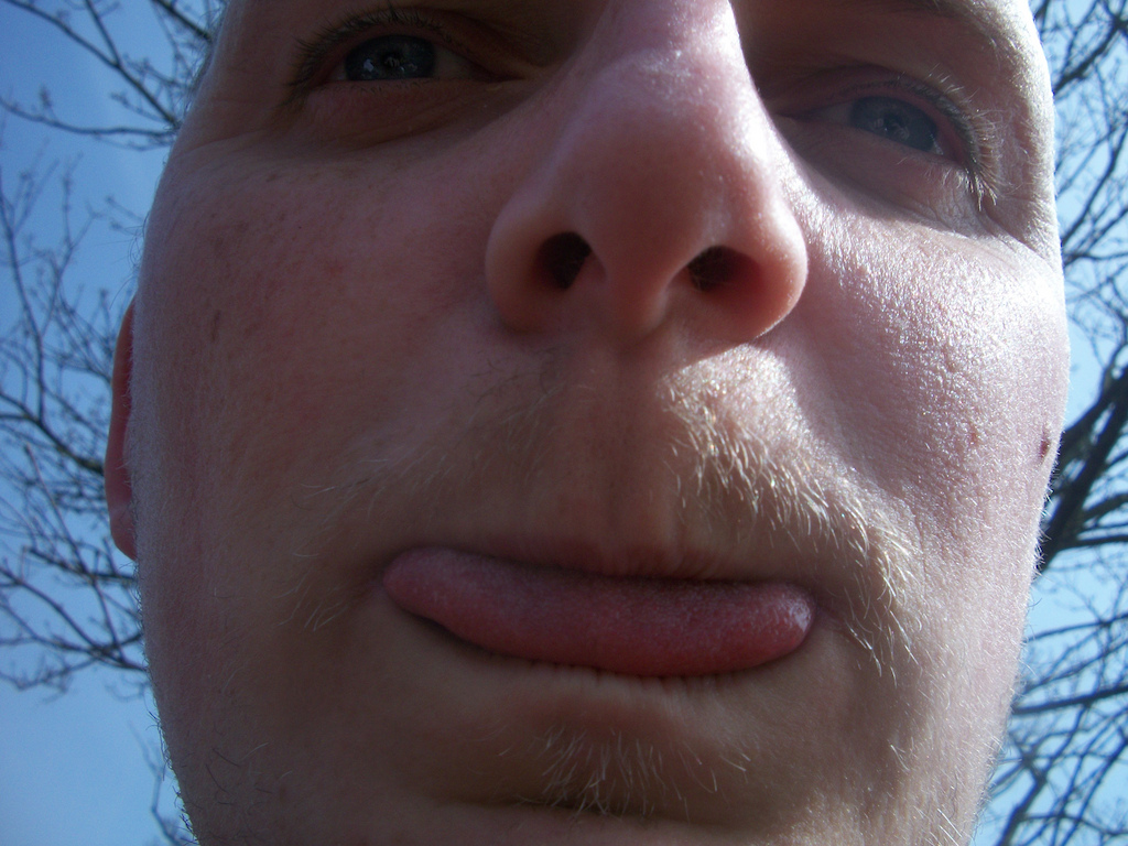 its Catweasel!!! proof james can grow hair!
