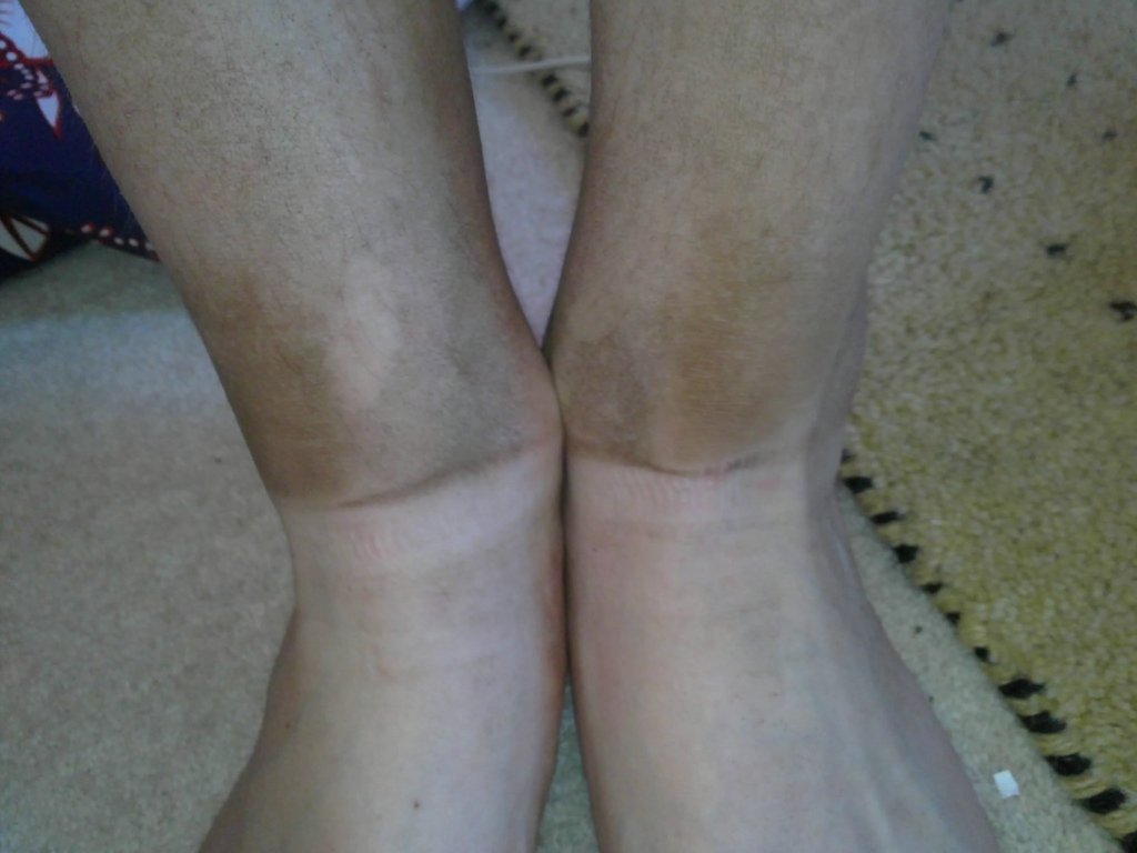 dirt line from my socks