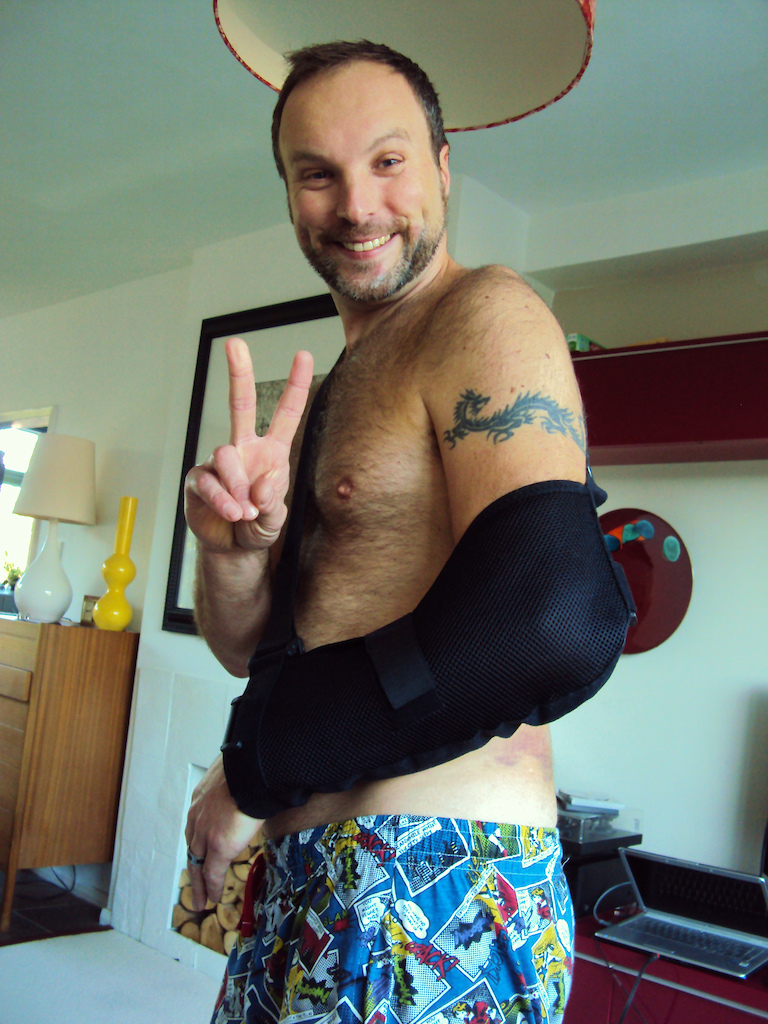 dislocated shoulder,dislocated collar bone,and 2 broken ribs!!i suppose its not to bad for 7 years of ridding!still  not fun!