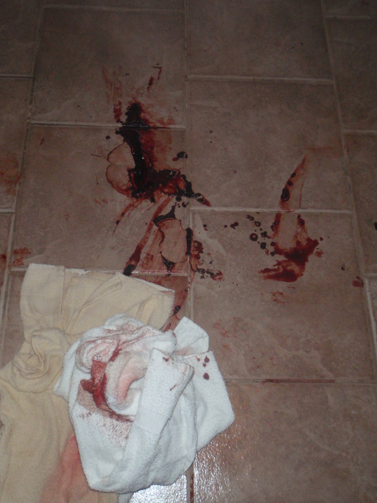 Some left overs from after I got picked up by the ambulance.
Wear shin pads on a new bike setup!