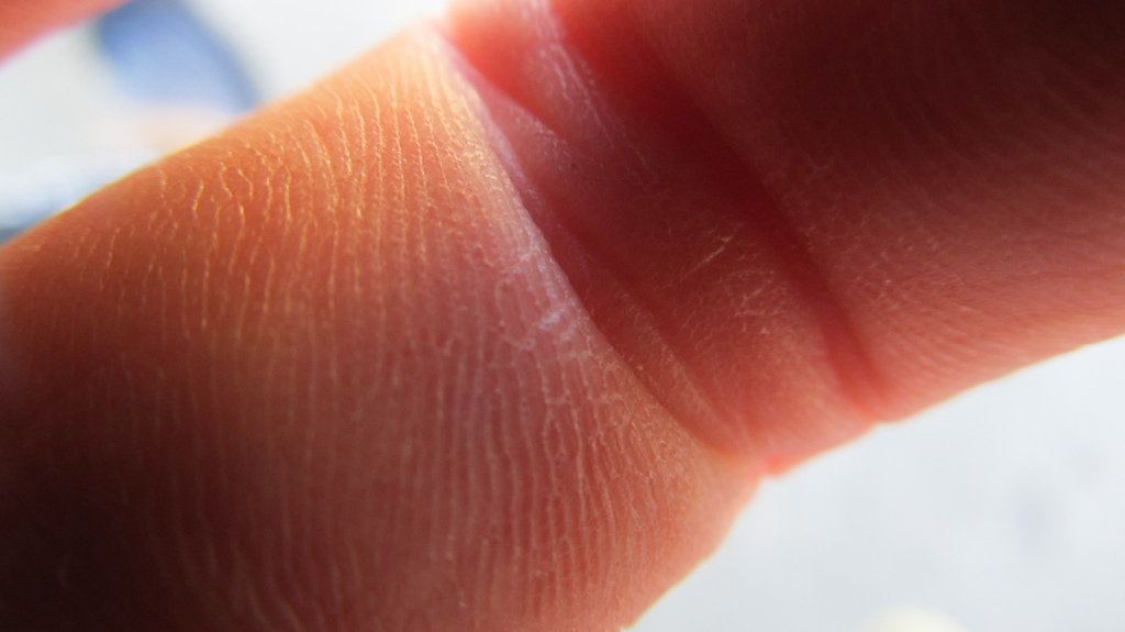 FINGER!!!!