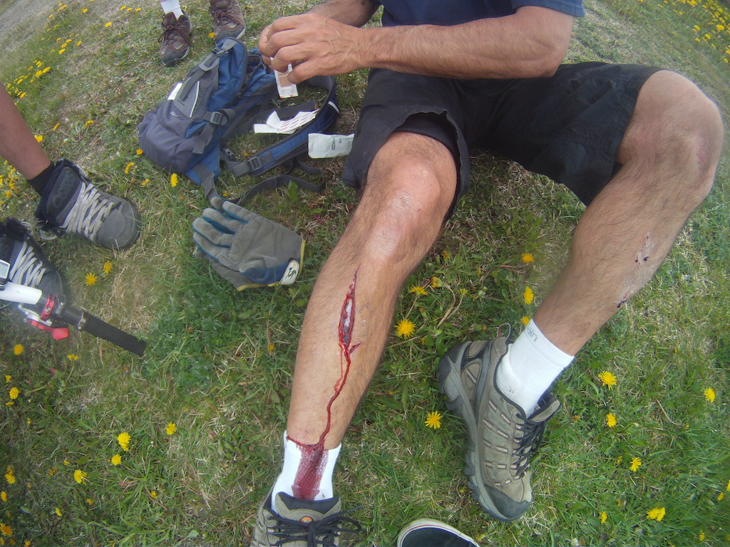 May 26th, 2012 - Best shinner for me to date!!!  17 stitches and a 2 day riding rest!