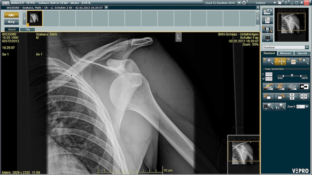skiing last day last ride
dislocated shoulder
