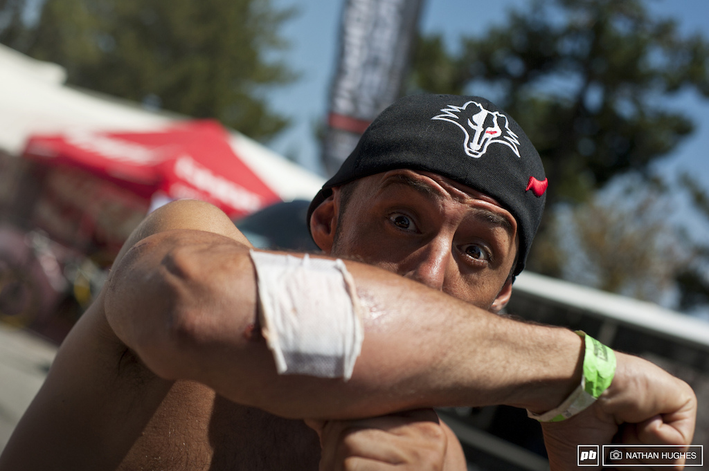 So bears are rare in Andorra but you still shouldn t walk the forest unaccompanied. That s what Cedric did and it took an elbow-parry just like this followed by a squirt of pepper spray to deflect a savage attack. Steve Peat was actually first on the scene so he can tell you the whole story.