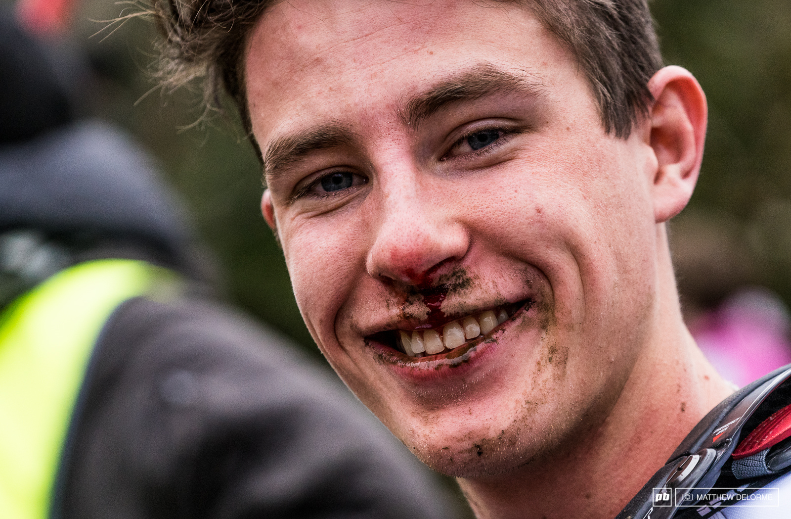 Still smiling through the mud and the blood.