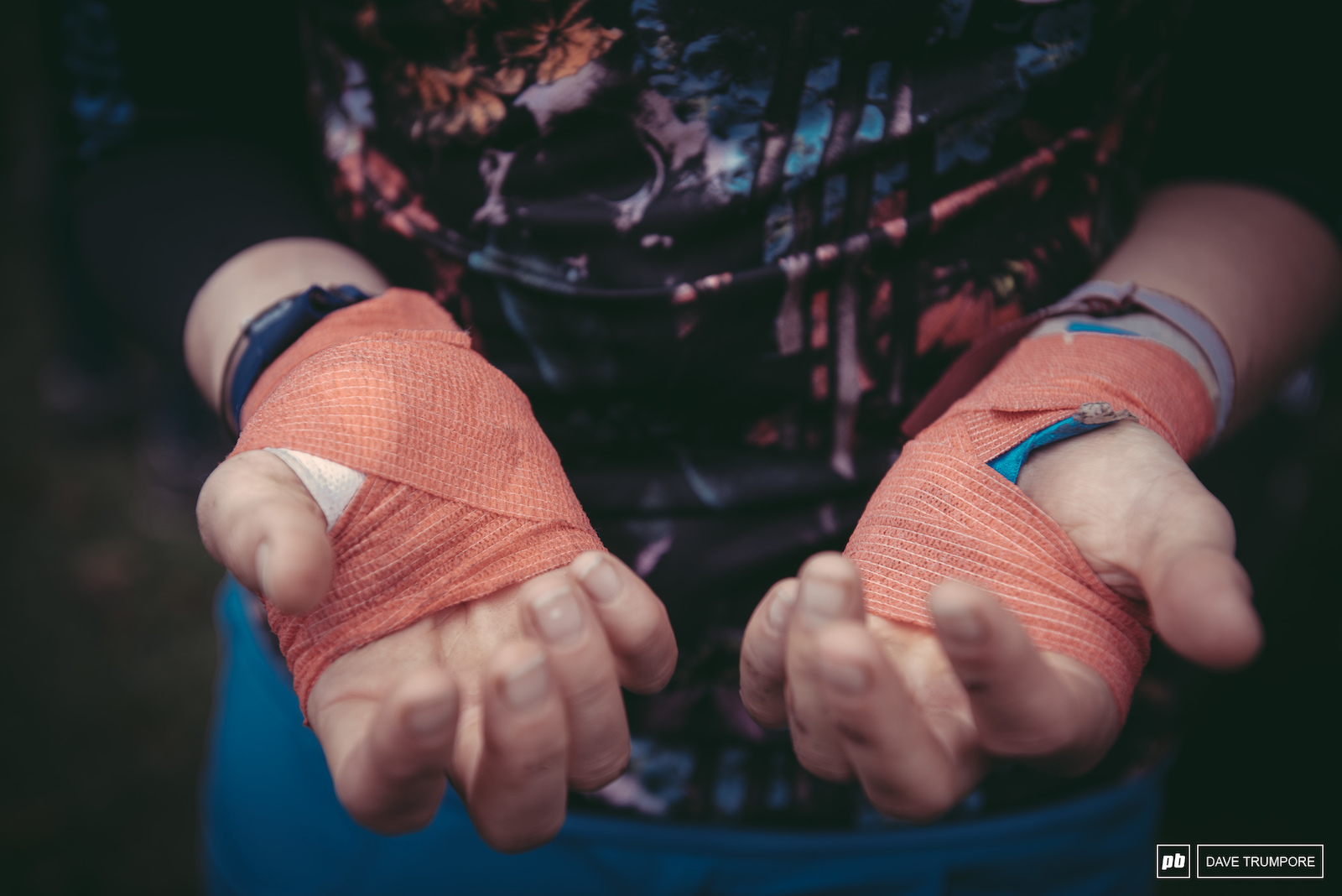 After a huge crash in Chile Anita Gehrig s hands are both taped and stitched together but she still soldiered on here in Colombia.