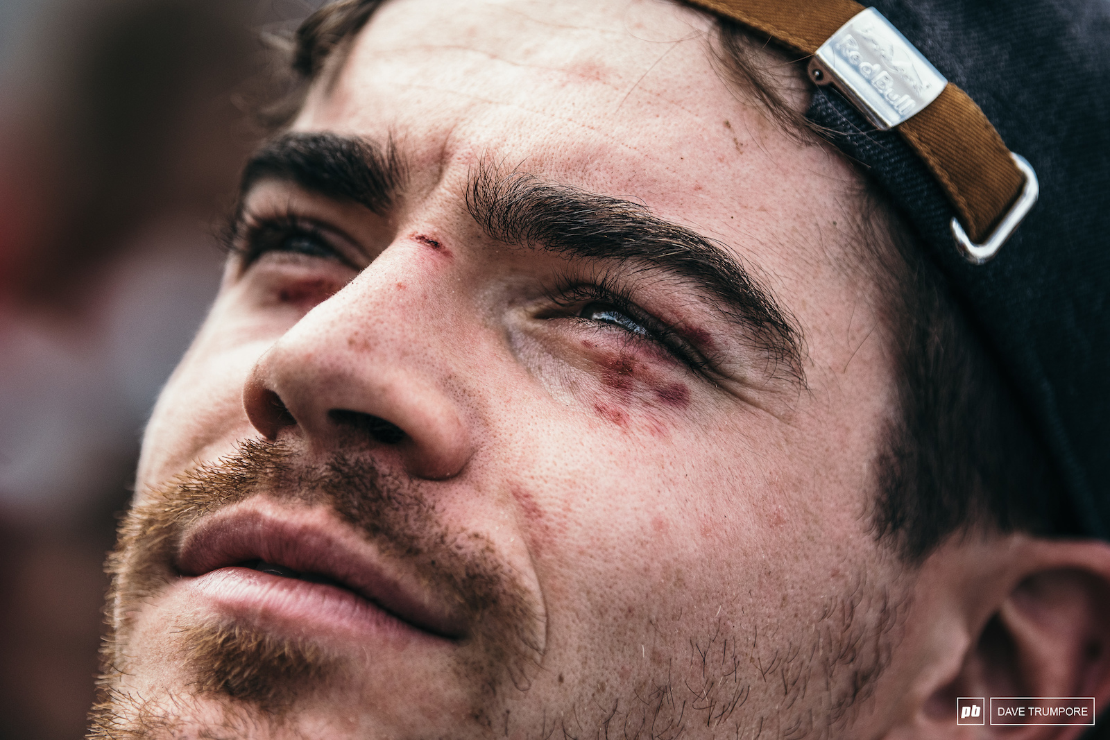 A brusised and battered Loic Bruni watching his countrymen Amaury Pierron and Loris Vergier climb not the podium.